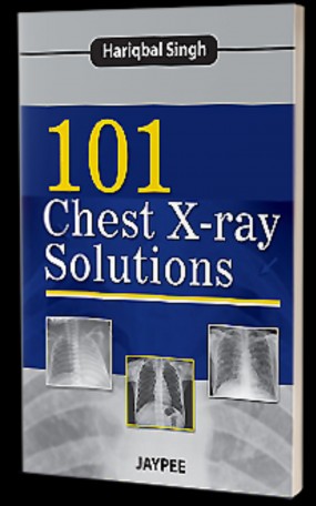 101 Chest X-Ray Solutions